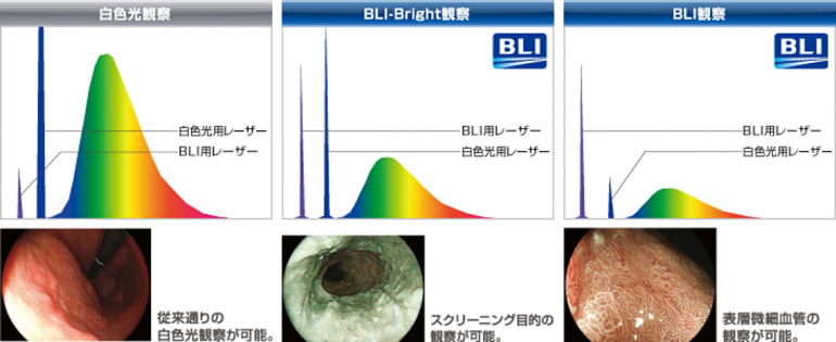 発光強度で切り替えられる観察タイプ